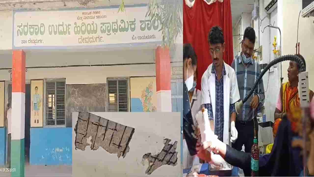 ರಾಯಚೂರು: ತರಗತಿ ವೇಳೆಯೇ ಮೇಲ್ಛಾವಣಿ ಕುಸಿತ; ಓರ್ವ ವಿದ್ಯಾರ್ಥಿನಿಗೆ ಗಾಯ