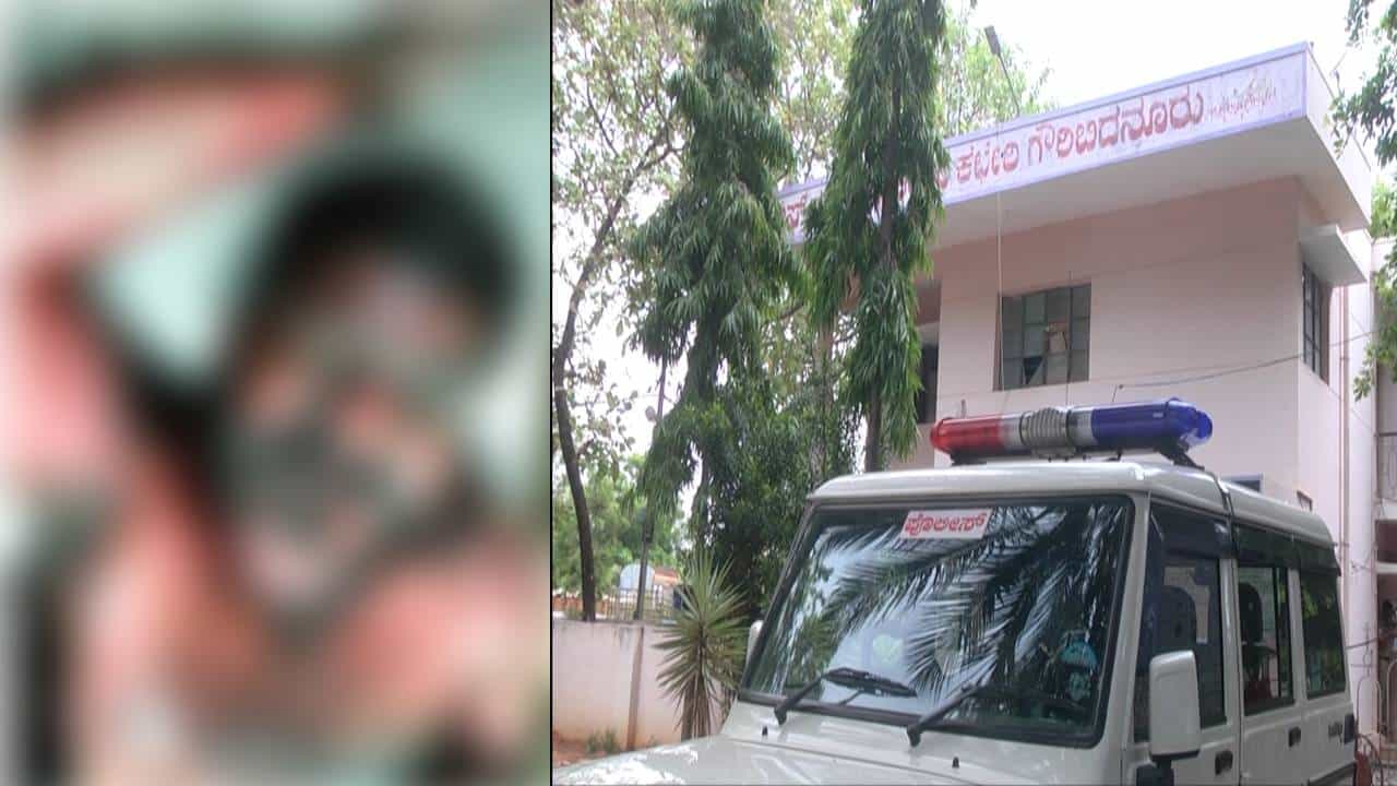 ಚಿಕ್ಕಬಳ್ಳಾಪುರ: ಬೆಂಕಿ ಹಚ್ಚಿಕೊಂಡ ದಂಪತಿ ಆತ್ಮಹತ್ಯೆಗೆ ಯತ್ನ, ಪತ್ನಿ ಸಾವು