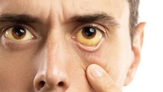 Men Health: ಪುರುಷರಲ್ಲಿ ಲೈಂಗಿಕ ಆಸಕ್ತಿಯನ್ನು ಹೆಚ್ಚಿಸಲು ಸಹಕಾರಿ ಈ ಗಿಡಮೂಲಿಕೆ