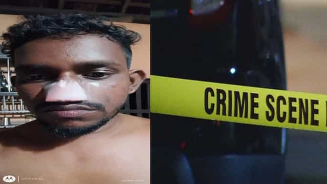 ಇಬ್ಬರ ನಡುವೆ ಜಗಳ; ಯುವಕನ ಮೂಗು ಕಚ್ಚಿ ತೆಗೆದ ವ್ಯಕ್ತಿ