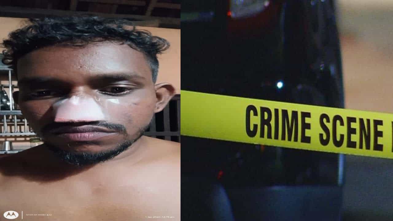 ಮಂಗಳೂರು: ಹೊಸ ವರ್ಷದ ಪಾರ್ಟಿ ವೇಳೆ ಇಬ್ಬರ ನಡುವೆ ಜಗಳ; ಯುವಕನ ಮೂಗು ಕಚ್ಚಿ ತೆಗೆದ ವ್ಯಕ್ತಿ ಮಂಗಳೂರು: ಹೊಸ ವರ್ಷದ ಪಾರ್ಟಿ ವೇಳೆ ಇಬ್ಬರ ನಡುವೆ ಜಗಳ; ಯುವಕನ ಮೂಗು ಕಚ್ಚಿ ತೆಗೆದ ವ್ಯಕ್ತಿ