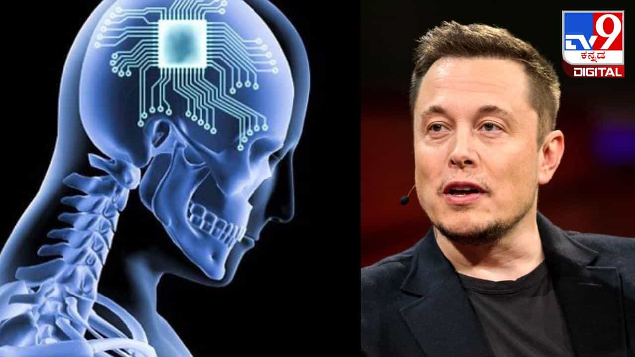 Neuralink: ಮಾನವನ ಮೆದುಳಿನಲ್ಲಿ ಮೊದಲ ರೋಬೋಟ್ ಚಿಪ್ ಅಳವಡಿಕೆ ಯಶಸ್ವಿ: ಎಲಾನ್ ಮಸ್ಕ್ Neuralink: ಮಾನವನ ಮೆದುಳಿನಲ್ಲಿ ಮೊದಲ ರೋಬೋಟ್ ಚಿಪ್ ಅಳವಡಿಕೆ ಯಶಸ್ವಿ: ಎಲಾನ್ ಮಸ್ಕ್