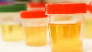 ಎಚ್ಚರವಿದ್ದಾಗಲೇ 5 ವರ್ಷದ ಕಂದಮ್ಮನಿಗೆ ಬ್ರೈನ್ ಸರ್ಜರಿ, ಈ ಶಸ್ತ್ರಚಿಕಿತ್ಸೆಗೆ ಒಳಗಾಗಿರುವ ವಿಶ್ವದ ಅತ್ಯಂತ ಕಿರಿಯ ವ್ಯಕ್ತಿ