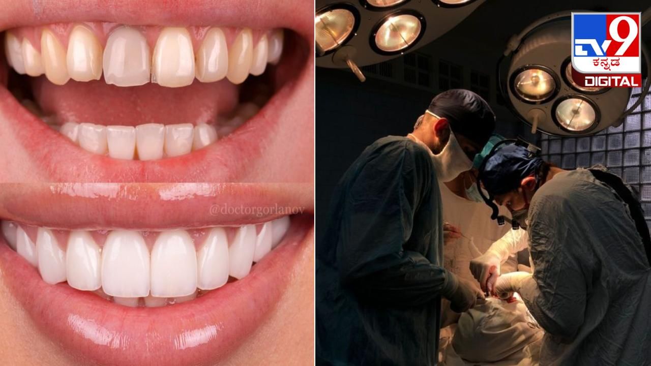 'Smile Designing' Surgery: ಹಲ್ಲಿನ ಚಂದ ಹೆಚ್ಚಿಸಲು ಹೋಗಿ ಸಾವನ್ನಪ್ಪಿದ ಮದುಮಗ 'Smile Designing' Surgery: ಹಲ್ಲಿನ ಚಂದ ಹೆಚ್ಚಿಸಲು ಹೋಗಿ ಸಾವನ್ನಪ್ಪಿದ ಮದುಮಗ