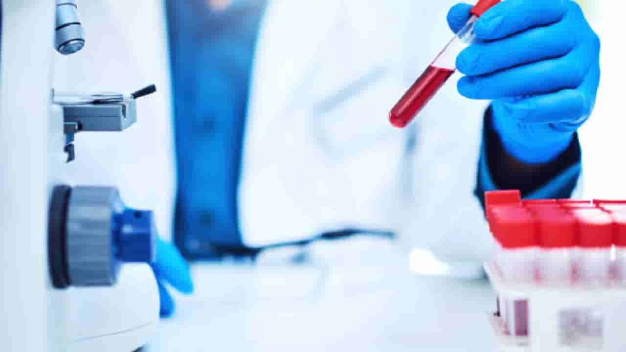 ವರ್ಷಕ್ಕೊಮ್ಮೆ ನೀವು ಮಾಡಿಸಲೇಬೇಕಾದ ರಕ್ಷ ಪರೀಕ್ಷೆಗಳಿವು