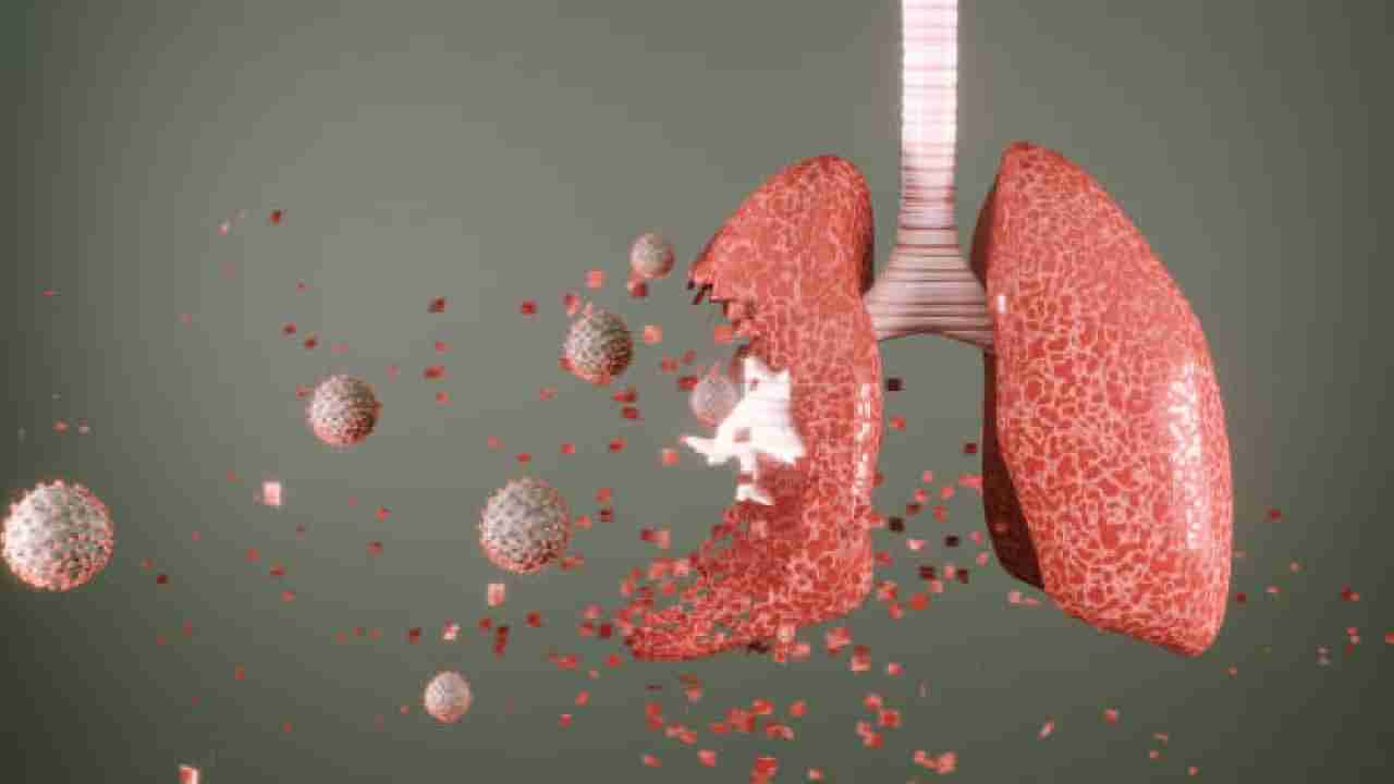 Lung Damage: ಕೊವಿಡ್ ನಂತರ ಶ್ವಾಸಕೋಶದ ತೊಂದರೆ ಹೆಚ್ಚಳ; ಅಧ್ಯಯನ