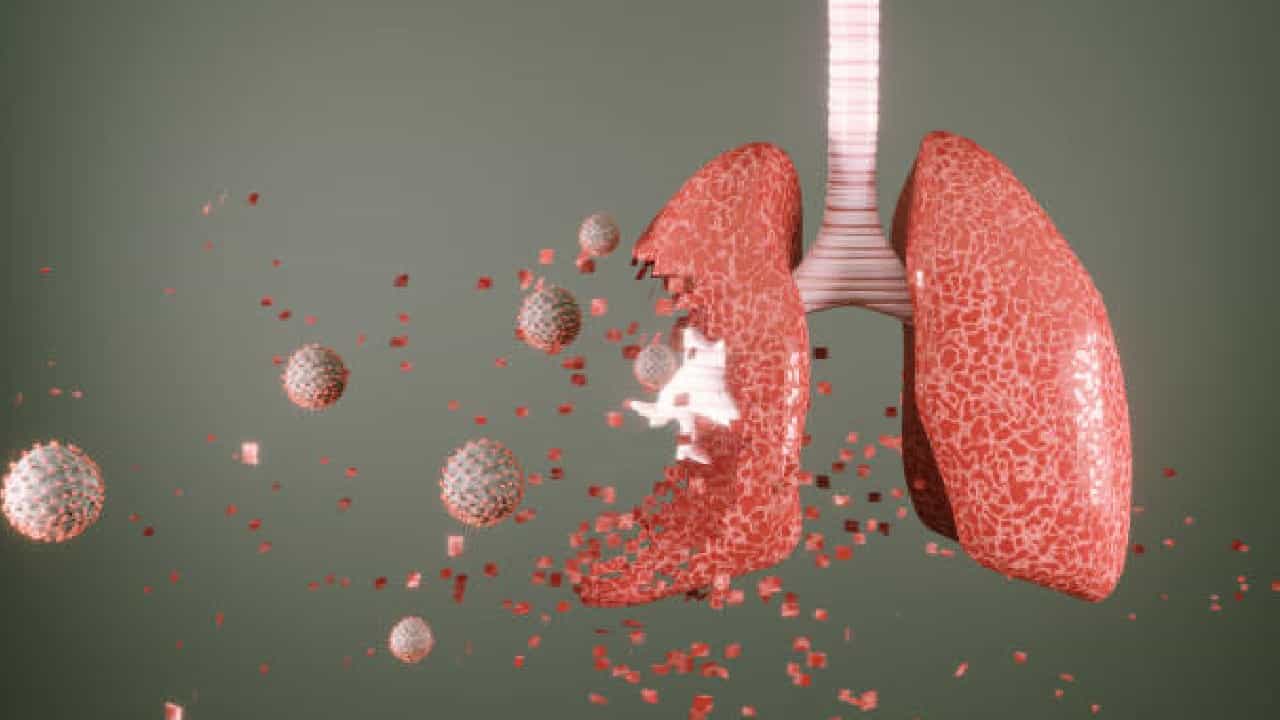 Lung Damage: ಕೊವಿಡ್ ನಂತರ ಶ್ವಾಸಕೋಶದ ತೊಂದರೆ ಹೆಚ್ಚಳ; ಅಧ್ಯಯನ Lung Damage: ಕೊವಿಡ್ ನಂತರ ಶ್ವಾಸಕೋಶದ ತೊಂದರೆ ಹೆಚ್ಚಳ; ಅಧ್ಯಯನ