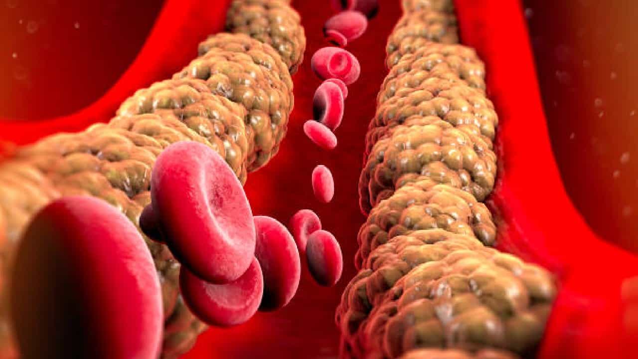 Cholesterol: ನಮ್ಮ ದೇಹದಲ್ಲಿರುವ ಕೆಟ್ಟ ಕೊಲೆಸ್ಟ್ರಾಲ್ ಯಾವುದು? ಒಳ್ಳೆಯ ಕೊಬ್ಬು ಯಾವುದು? Cholesterol: ನಮ್ಮ ದೇಹದಲ್ಲಿರುವ ಕೆಟ್ಟ ಕೊಲೆಸ್ಟ್ರಾಲ್ ಯಾವುದು? ಒಳ್ಳೆಯ ಕೊಬ್ಬು ಯಾವುದು?