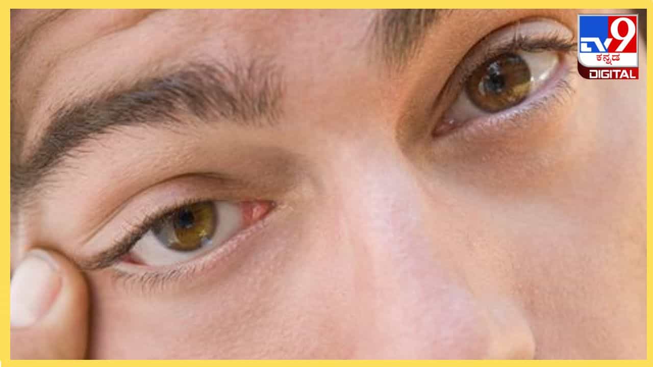 Eye Twitching: ಕಣ್ಣಿನ ಸೆಳೆತ ಏನನ್ನು ಸೂಚಿಸುತ್ತದೆ? ಇದರ ಹಿಂದಿರುವ ಮೂಢನಂಬಿಕೆ ನಿಜವೇ? Eye Twitching: ಕಣ್ಣಿನ ಸೆಳೆತ ಏನನ್ನು ಸೂಚಿಸುತ್ತದೆ? ಇದರ ಹಿಂದಿರುವ ಮೂಢನಂಬಿಕೆ ನಿಜವೇ?