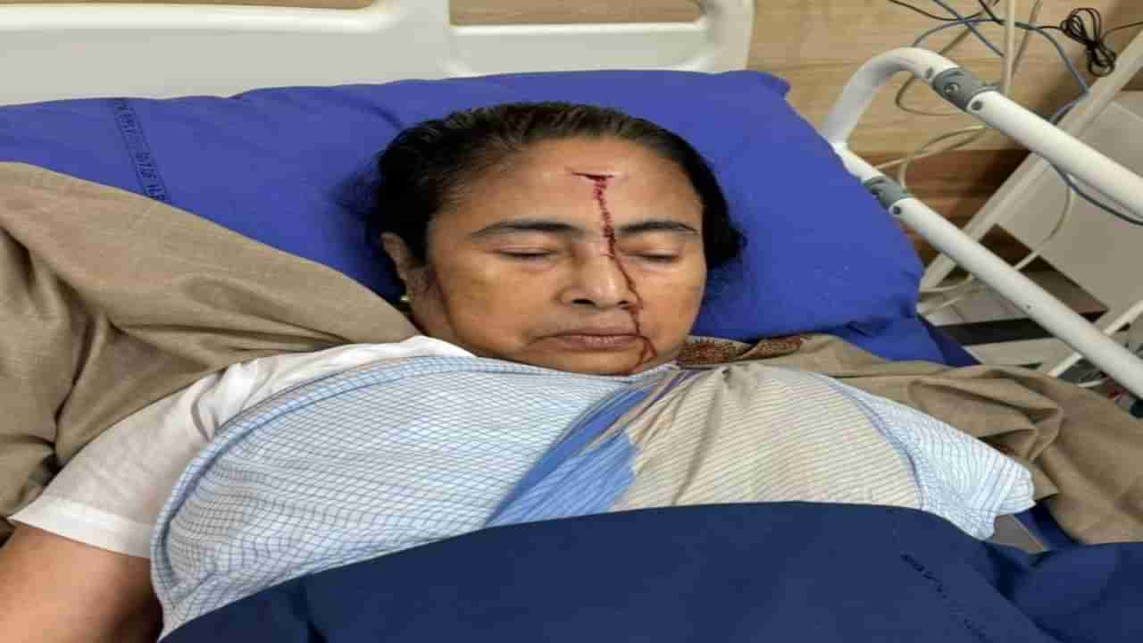 Mamata banerjee: ಮಮತಾ ಬ್ಯಾನರ್ಜಿ ಹಣೆಗೆ ಪೆಟ್ಟು; ಫೋಟೊ ಟ್ವೀಟ್ ಮಾಡಿದ ಟಿಎಂಸಿ