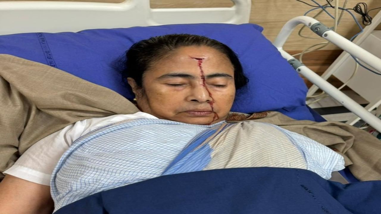 Mamata banerjee: ಮಮತಾ ಬ್ಯಾನರ್ಜಿ ಹಣೆಗೆ ಪೆಟ್ಟು; ಫೋಟೊ ಟ್ವೀಟ್ ಮಾಡಿದ ಟಿಎಂಸಿ