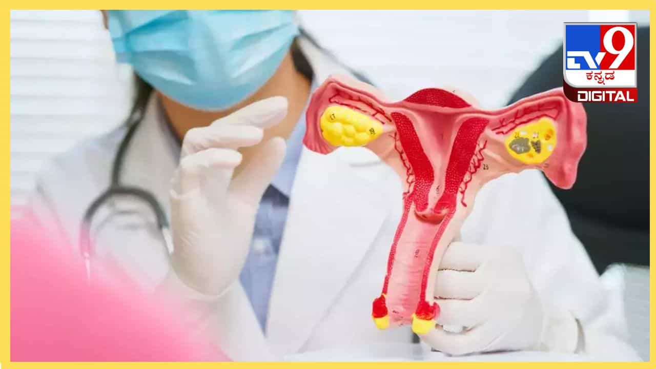 Uterus Didelphys: ಈ ಯುವತಿಗೆ ಎರಡು ಗರ್ಭಕೋಶ, ಎರಡು ಯೋನಿ, ಇದು ಗರ್ಭಾಶಯದ ಡಿಡೆಲ್ಸಿಸ್ ಕಾಯಿಲೆ? Uterus Didelphys: ಈ ಯುವತಿಗೆ ಎರಡು ಗರ್ಭಕೋಶ, ಎರಡು ಯೋನಿ, ಇದು ಗರ್ಭಾಶಯದ ಡಿಡೆಲ್ಸಿಸ್ ಕಾಯಿಲೆ?