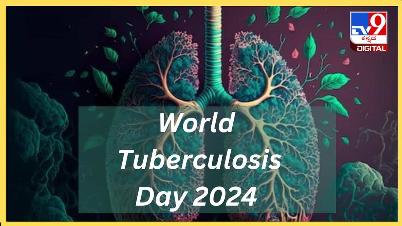 World Tuberculosis Day 2024: ಟಿಬಿ ಬಗ್ಗೆ ಭಯಬೇಡ, ಈ ಚಿಕಿತ್ಸೆಯಿಂದ ಕ್ಷಯ ಶಮನ World Tuberculosis Day 2024: ಟಿಬಿ ಬಗ್ಗೆ ಭಯಬೇಡ, ಈ ಚಿಕಿತ್ಸೆಯಿಂದ ಕ್ಷಯ ಶಮನ