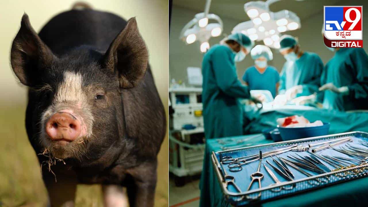 Pig Kidney Transplant: ಮನುಷ್ಯನಿಗೆ ಹಂದಿಯ ಕಿಡ್ನಿ ಕಸಿ ಮಾಡಿದ ವೈದ್ಯರು; ವೈದ್ಯಕೀಯ ಇತಿಹಾಸದಲ್ಲೇ ಪ್ರಥಮ ಪ್ರಯತ್ನ Pig Kidney Transplant: ಮನುಷ್ಯನಿಗೆ ಹಂದಿಯ ಕಿಡ್ನಿ ಕಸಿ ಮಾಡಿದ ವೈದ್ಯರು; ವೈದ್ಯಕೀಯ ಇತಿಹಾಸದಲ್ಲೇ ಪ್ರಥಮ ಪ್ರಯತ್ನ