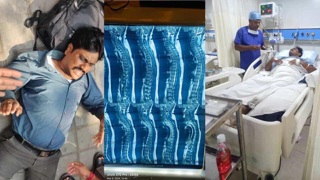 ಬಿಬಿಎಂಪಿ ನಿರ್ಲಕ್ಷ್ಯ; ಮರದ ಕೊಂಬೆ ಮುರಿದು ಬಿದ್ದು ಬೈಕ್ ಸವಾರನ ಬೆನ್ನು ಮೂಳೆ ಮುರಿತ ಬಿಬಿಎಂಪಿ ನಿರ್ಲಕ್ಷ್ಯ; ಮರದ ಕೊಂಬೆ ಮುರಿದು ಬಿದ್ದು ಬೈಕ್ ಸವಾರನ ಬೆನ್ನು ಮೂಳೆ ಮುರಿತ