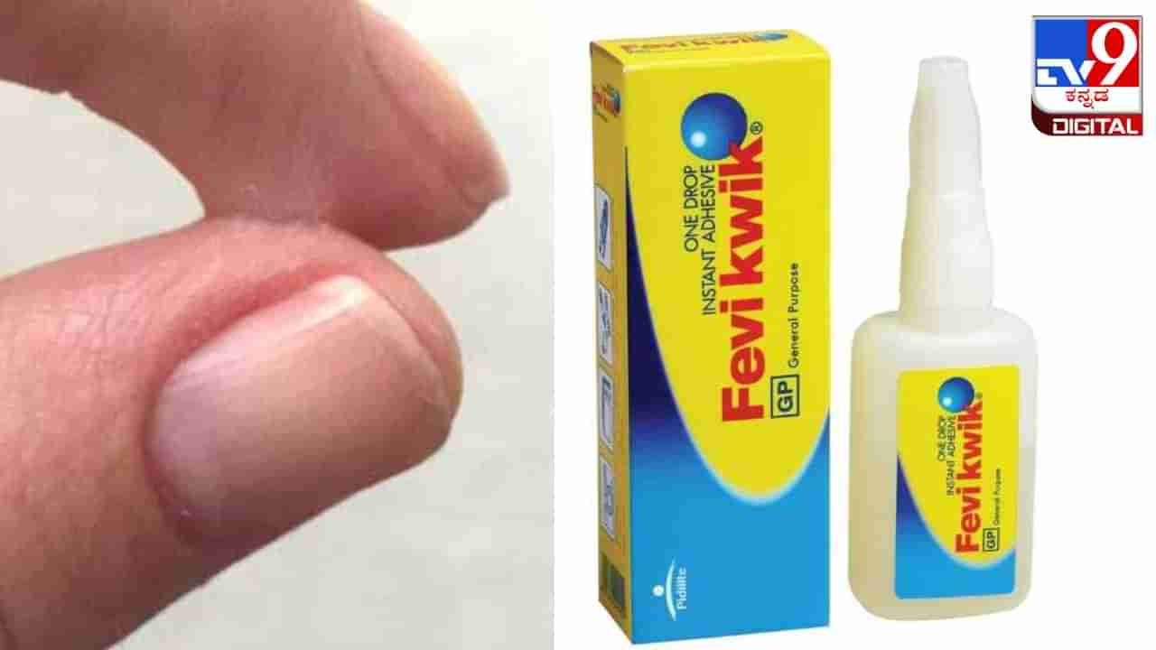 Viral Video: ಫೆವಿಕ್ವಿಕ್ ಕೈಗಳಿಗೆ ಅಂಟಿಕೊಂಡರೆ ಚಿಂತಿಸಬೇಡಿ; ಸಿಂಪಲ್ ಟಿಪ್ಸ್ ಇಲ್ಲಿದೆ