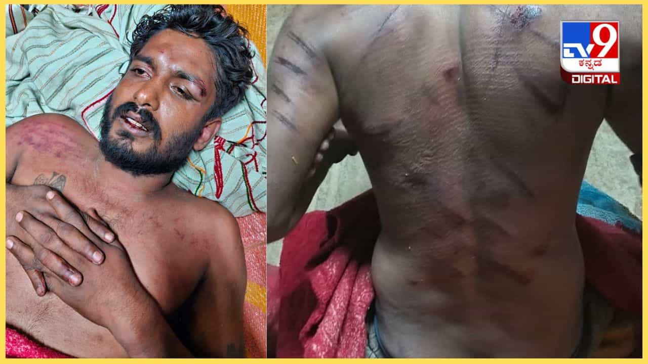 ರಾಮನಗರ: ಬಿಜೆಪಿ ಪರ ಮತಯಾಚನೆ ಮಾಡಿದ್ದಕ್ಕೆ ಗಿರಿಗೌಡನ ದೊಡ್ಡಿಯಲ್ಲಿ ವ್ಯಕ್ತಿ ಮೇಲೆ ಹಲ್ಲೆ