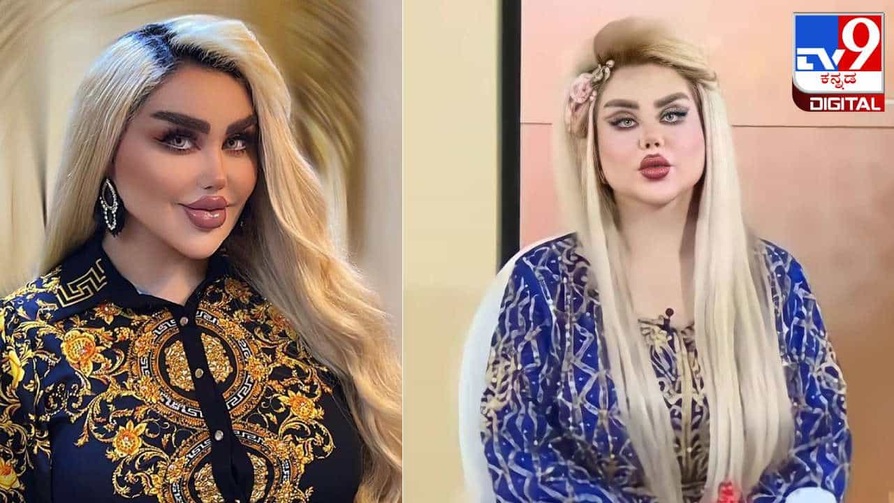 Plastic Surgery: ಬಾರ್ಬಿ ಡಾಲ್ ತರ ಕಾಣಲು 43 ಶಸ್ತ್ರಚಿಕಿತ್ಸೆಗೆ ಒಳಗಾದ ಯುವತಿ Plastic Surgery: ಬಾರ್ಬಿ ಡಾಲ್ ತರ ಕಾಣಲು 43 ಶಸ್ತ್ರಚಿಕಿತ್ಸೆಗೆ ಒಳಗಾದ ಯುವತಿ