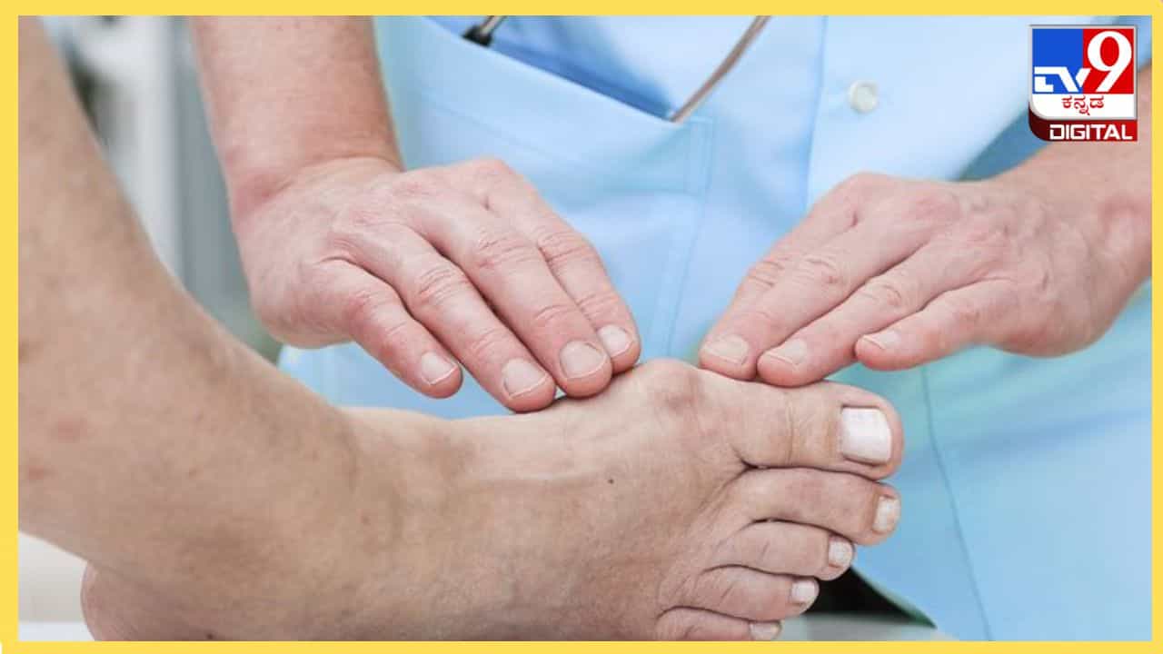 Numbness : ಕೈ ಕಾಲುಗಳು ಮರಗಟ್ಟಿದಂತಹ ಅನುಭವವಾಗುತ್ತಿದೆಯೇ, ಟೆನ್ಶನ್ ಬೇಡ ಮನೆಯಲ್ಲೇ ಇದೆ ಔಷಧಿ Numbness : ಕೈ ಕಾಲುಗಳು ಮರಗಟ್ಟಿದಂತಹ ಅನುಭವವಾಗುತ್ತಿದೆಯೇ, ಟೆನ್ಶನ್ ಬೇಡ ಮನೆಯಲ್ಲೇ ಇದೆ ಔಷಧಿ