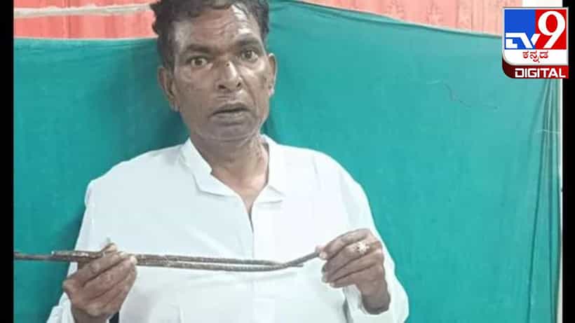 Viral News: ಹೃದಯಕ್ಕೆ ಚುಚ್ಚಿದ್ದ ಕಬ್ಬಿಣದ ರಾಡ್ನ್ನು ಯಶಸ್ವಿಯಾಗಿ ಹೊರತೆಗೆದ ವೈದ್ಯರು