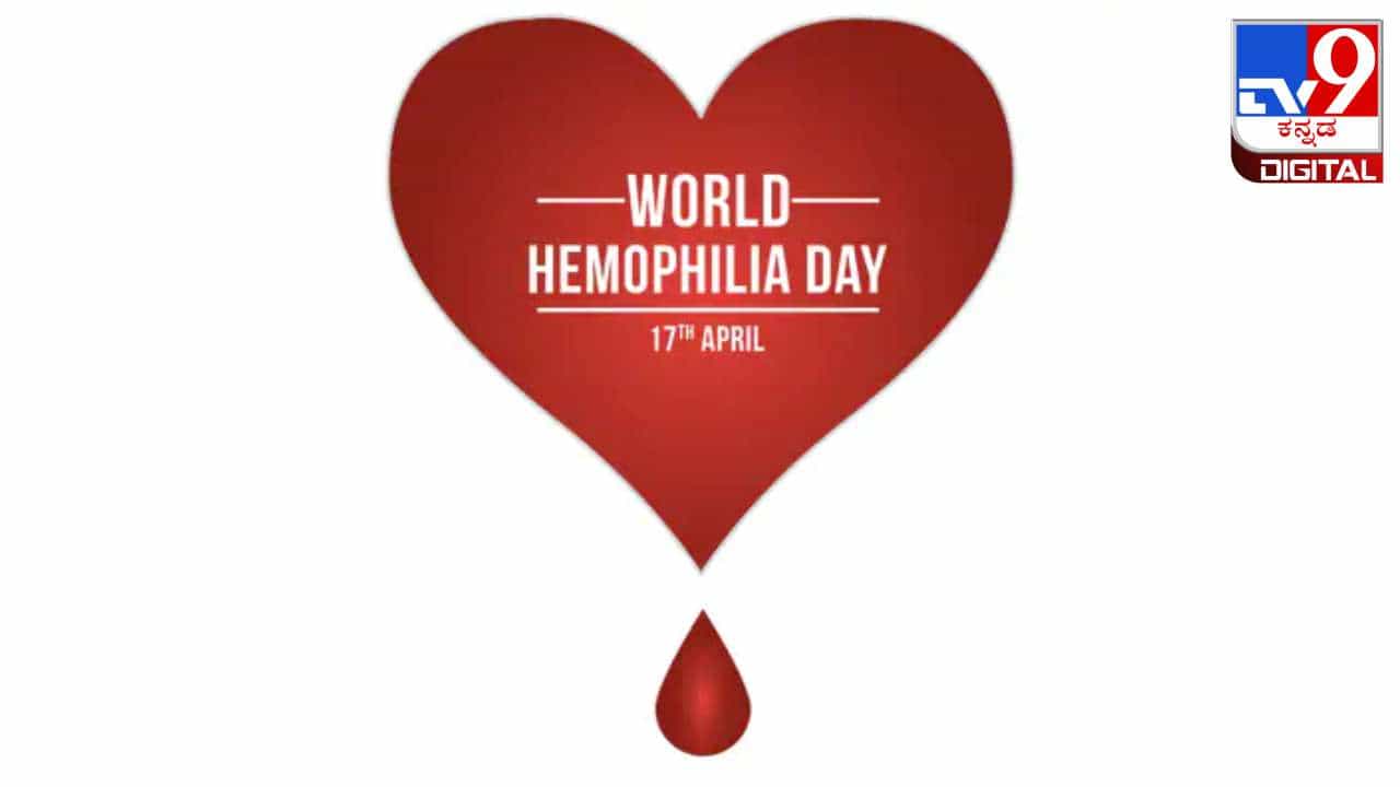 World Hemophilia Day 2024: ರಕ್ತಸ್ರಾವ ನಿಲ್ಲುತ್ತಿಲ್ಲವೇ, ಈ ರೋಗದ ಲಕ್ಷಣವಾಗಿರಬಹುದು ಜೋಕೆ! World Hemophilia Day 2024: ರಕ್ತಸ್ರಾವ ನಿಲ್ಲುತ್ತಿಲ್ಲವೇ, ಈ ರೋಗದ ಲಕ್ಷಣವಾಗಿರಬಹುದು ಜೋಕೆ!
