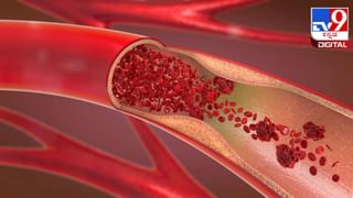 Exercise and Sleeping Hours: ದಿನಕ್ಕೆ ಇಂತಿಷ್ಟು ಗಂಟೆ ನಿದ್ದೆ, ವ್ಯಾಯಾಮ ಮಾಡಬೇಕು: ಸಂಶೋಧನೆ