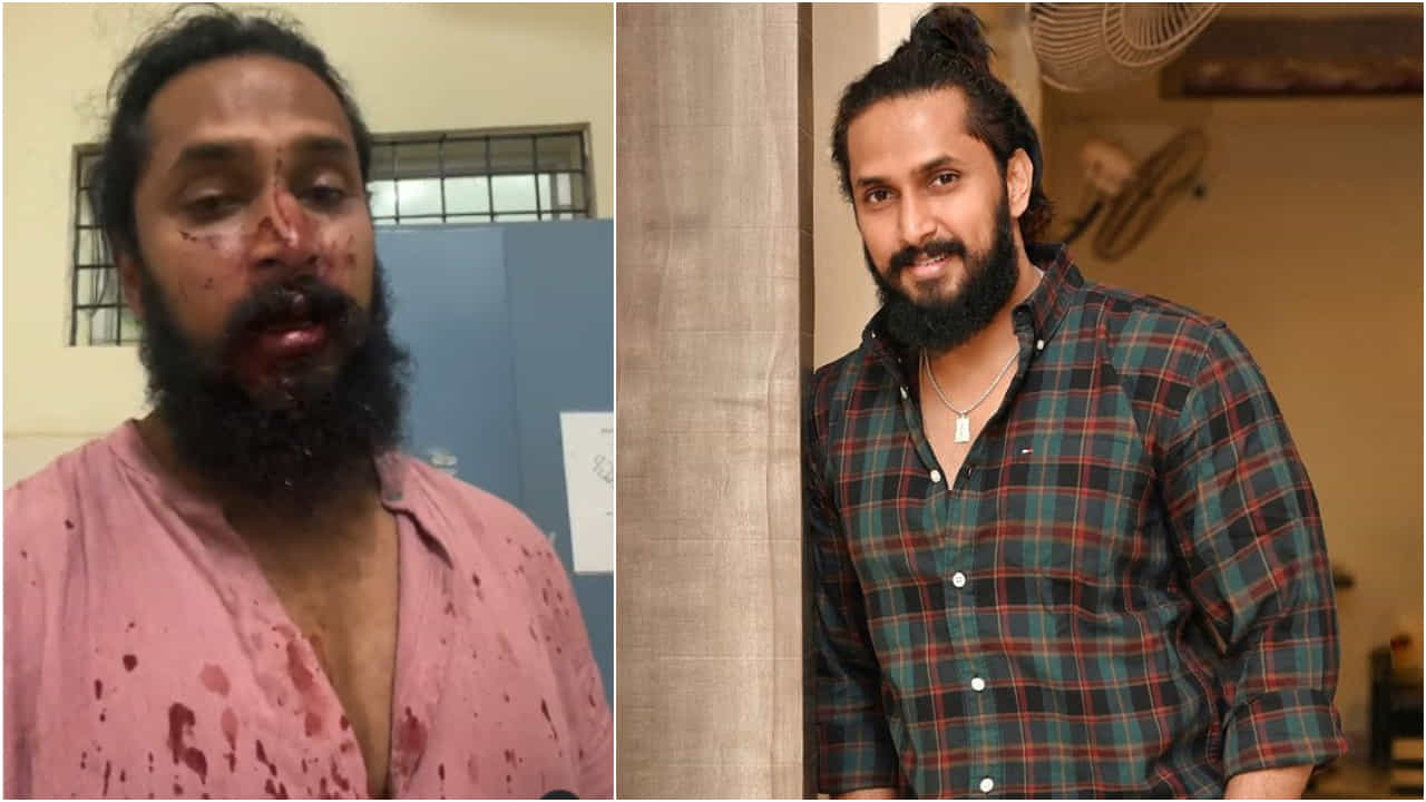 Chetan Chandra: ಕನ್ನಡದ ನಟ ಚೇತನ್ ಚಂದ್ರ ಮೇಲೆ ಬೆಂಗಳೂರಿನಲ್ಲಿ 20 ಜನರಿಂದ ಹಲ್ಲೆ Chetan Chandra: ಕನ್ನಡದ ನಟ ಚೇತನ್ ಚಂದ್ರ ಮೇಲೆ ಬೆಂಗಳೂರಿನಲ್ಲಿ 20 ಜನರಿಂದ ಹಲ್ಲೆ