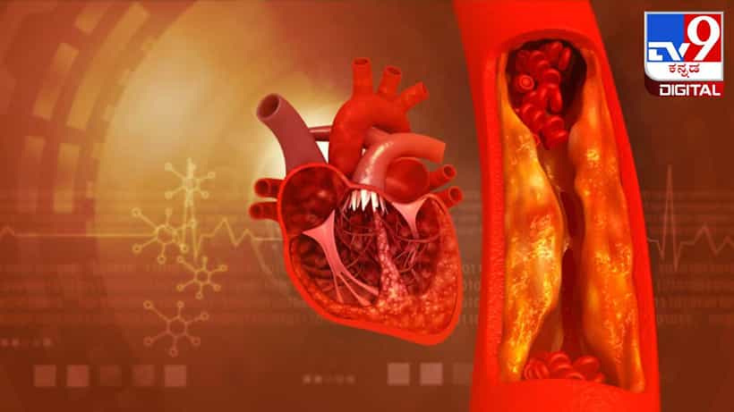 Health Tips: ಅಪಧಮನಿಗಳನ್ನು ಆರೋಗ್ಯಕರವಾಗಿ ಇಡಲು ಈ ವಿಟಮಿನ್ ಬಹಳ ಮುಖ್ಯ