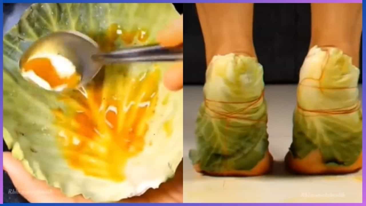 Home Remedies: ಪಾದ, ಹಿಮ್ಮಡಿ ನೋವಿಗೆ ಎಲೆಕೋಸಿನಿಂದ ಮುಕ್ತಿ Home Remedies: ಪಾದ, ಹಿಮ್ಮಡಿ ನೋವಿಗೆ ಎಲೆಕೋಸಿನಿಂದ ಮುಕ್ತಿ