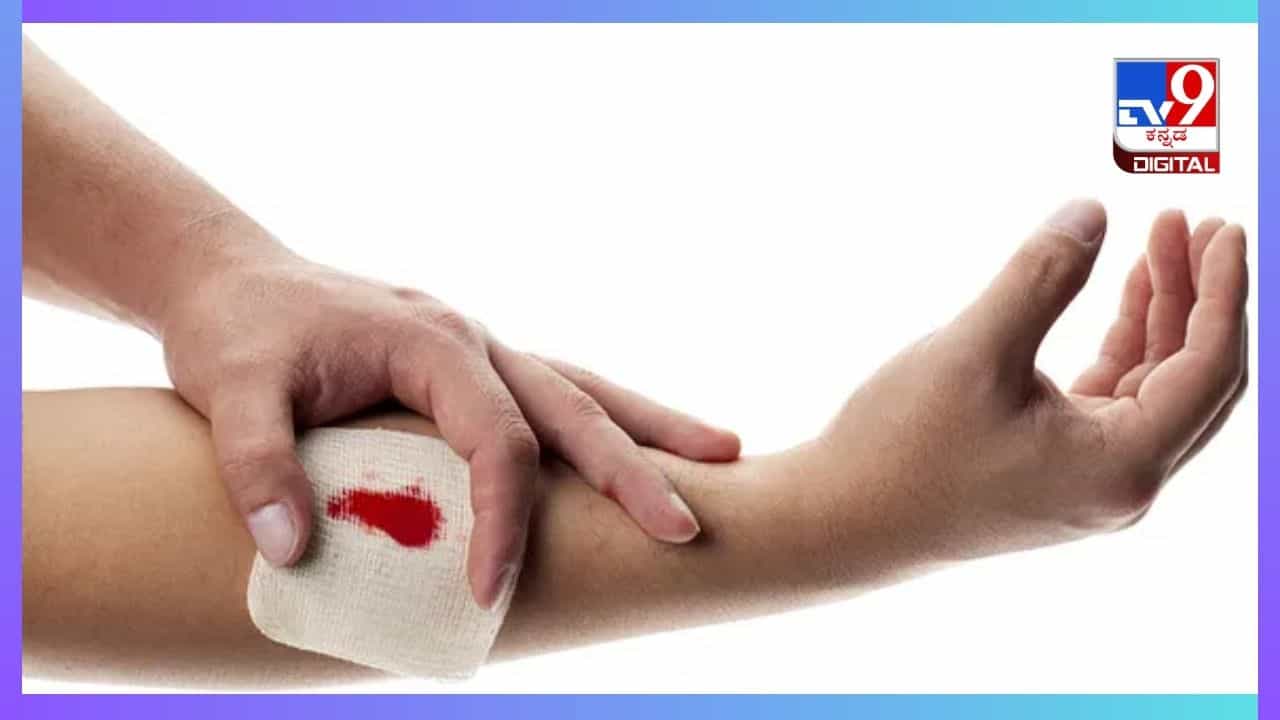 Home Remedies : ಗಾಯವಾಗಿ ರಕ್ತಸ್ರಾವವಾಗುತ್ತಿದ್ದರೆ ತಕ್ಷಣಕ್ಕೆ ನಿಲ್ಲಿಸೋದು ಹೇಗೆ? ಇಲ್ಲಿದೆ ಸರಳ ಮನೆ ಮದ್ದು Home Remedies : ಗಾಯವಾಗಿ ರಕ್ತಸ್ರಾವವಾಗುತ್ತಿದ್ದರೆ ತಕ್ಷಣಕ್ಕೆ ನಿಲ್ಲಿಸೋದು ಹೇಗೆ? ಇಲ್ಲಿದೆ ಸರಳ ಮನೆ ಮದ್ದು