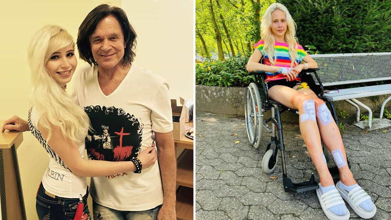 Limb Lengthening: 57 ವರ್ಷದ ಪ್ರಿಯಕರನ ಮನ ಒಲಿಸಲು ಯುವತಿ ಮಾಡಿದ ಕಸರತ್ತು ಏನು ಗೊತ್ತಾ?