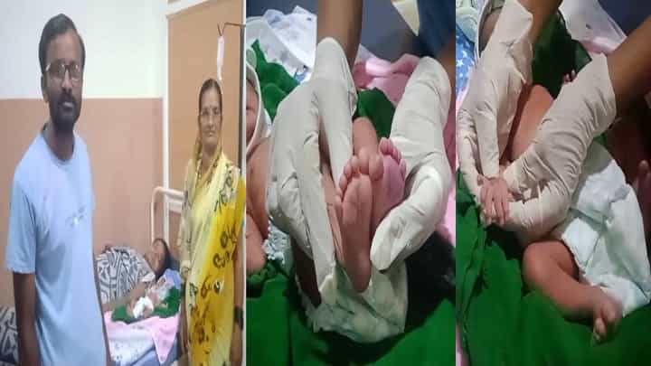 ರಬಕವಿಯಲ್ಲಿ 25 ಬೆರಳುಗಳು ಇರೋ ಅಪರೂಪದ ಮಗು ಜನನ ರಬಕವಿಯಲ್ಲಿ 25 ಬೆರಳುಗಳು ಇರೋ ಅಪರೂಪದ ಮಗು ಜನನ