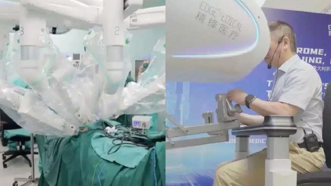 Telesurgery: 8,000 ಕಿಮೀ ದೂರದಿಂದ ರೋಗಿಗೆ ರೋಬೋಟಿಕ್ ಸರ್ಜರಿ ಮಾಡಿದ ವೈದ್ಯರು Telesurgery: 8,000 ಕಿಮೀ ದೂರದಿಂದ ರೋಗಿಗೆ ರೋಬೋಟಿಕ್ ಸರ್ಜರಿ ಮಾಡಿದ ವೈದ್ಯರು