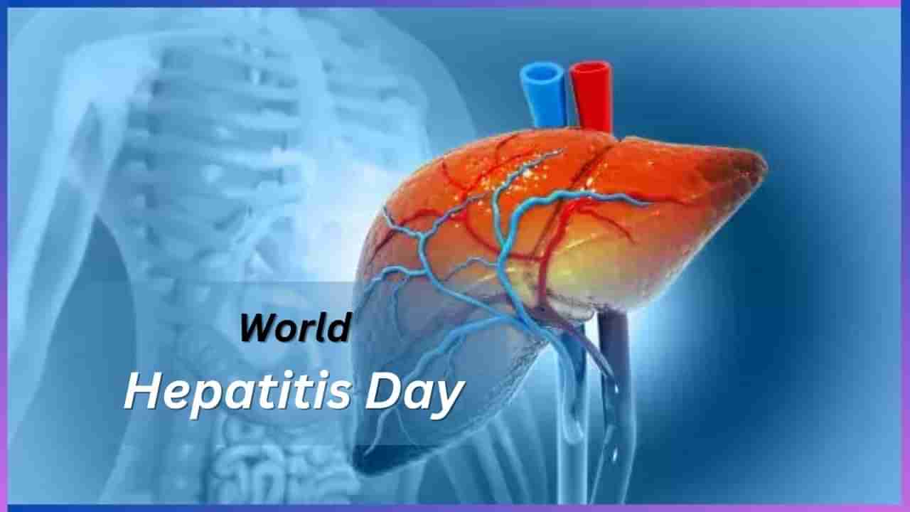 World Hepatitis Day 2024: ಏನಿದು ಹೆಪಟೈಟಿಸ್ ಕಾಯಿಲೆ? ಈ ರೋಗ ಲಕ್ಷಣಗಳೇನು? ತಡೆಗಟ್ಟುವುದು ಹೇಗೆ?