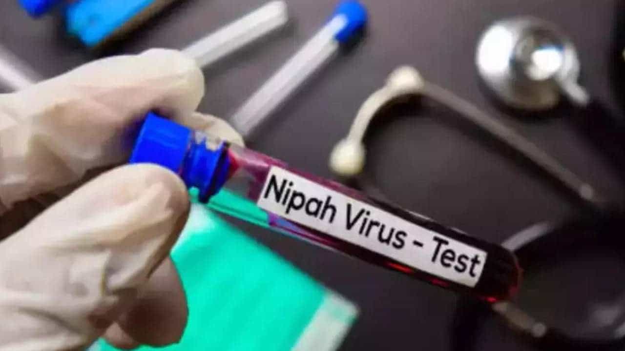 Nipah Virus: ನಿಫಾ ವೈರಸ್ ಸೋಂಕಿತ 14 ವರ್ಷದ ಕೇರಳ ಬಾಲಕ ಹೃದಯಸ್ತಂಭನದಿಂದ ನಿಧನ Nipah Virus: ನಿಫಾ ವೈರಸ್ ಸೋಂಕಿತ 14 ವರ್ಷದ ಕೇರಳ ಬಾಲಕ ಹೃದಯಸ್ತಂಭನದಿಂದ ನಿಧನ