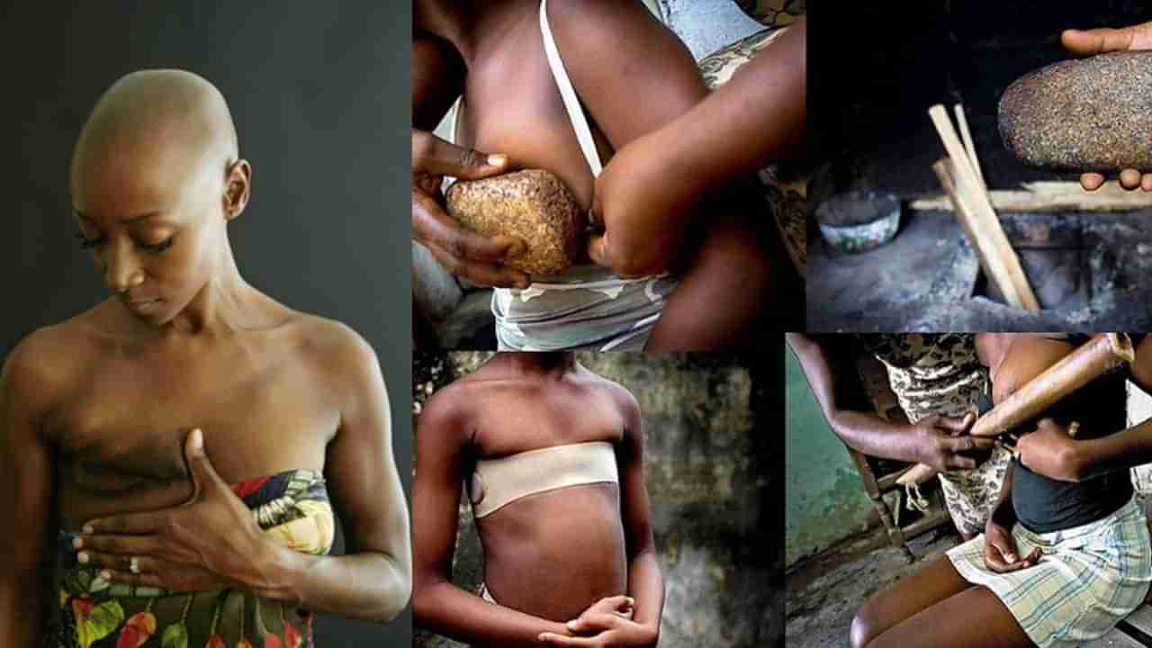 Breast Ironing: ಹೆಣ್ಣು ಮಕ್ಕಳ ಲೈಂಗಿಕ ಆಕರ್ಷಣೆಯನ್ನು ಹತ್ತಿಕ್ಕಲು ಈ ದೇಶದಲ್ಲಿ ಏನು ಮಾಡುತ್ತಾರೆ ಗೊತ್ತಾ?