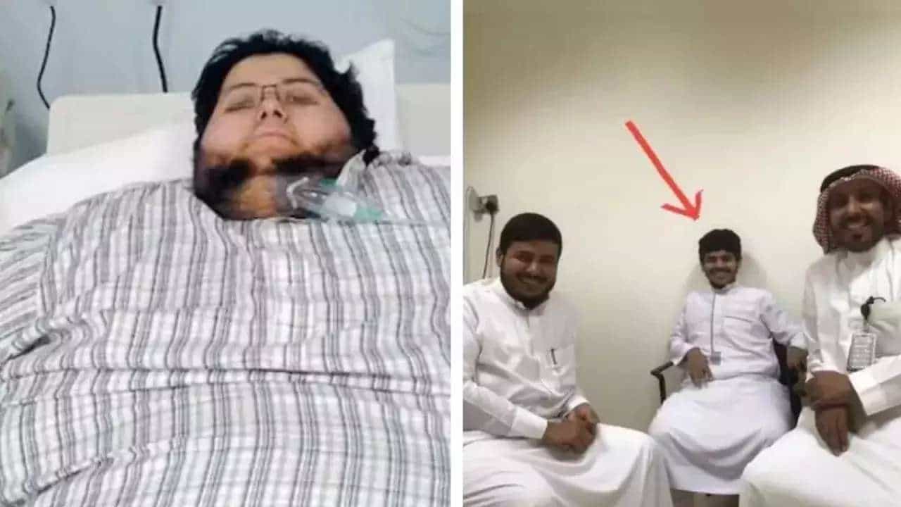 Viral News: 6 ತಿಂಗಳಲ್ಲಿ 540 ಕೆಜಿಯಿಂದ 60 ಕೆಜಿಗೆ ತೂಕ ಇಳಿಸಿಕೊಂಡ ವ್ಯಕ್ತಿ Viral News: 6 ತಿಂಗಳಲ್ಲಿ 540 ಕೆಜಿಯಿಂದ 60 ಕೆಜಿಗೆ ತೂಕ ಇಳಿಸಿಕೊಂಡ ವ್ಯಕ್ತಿ