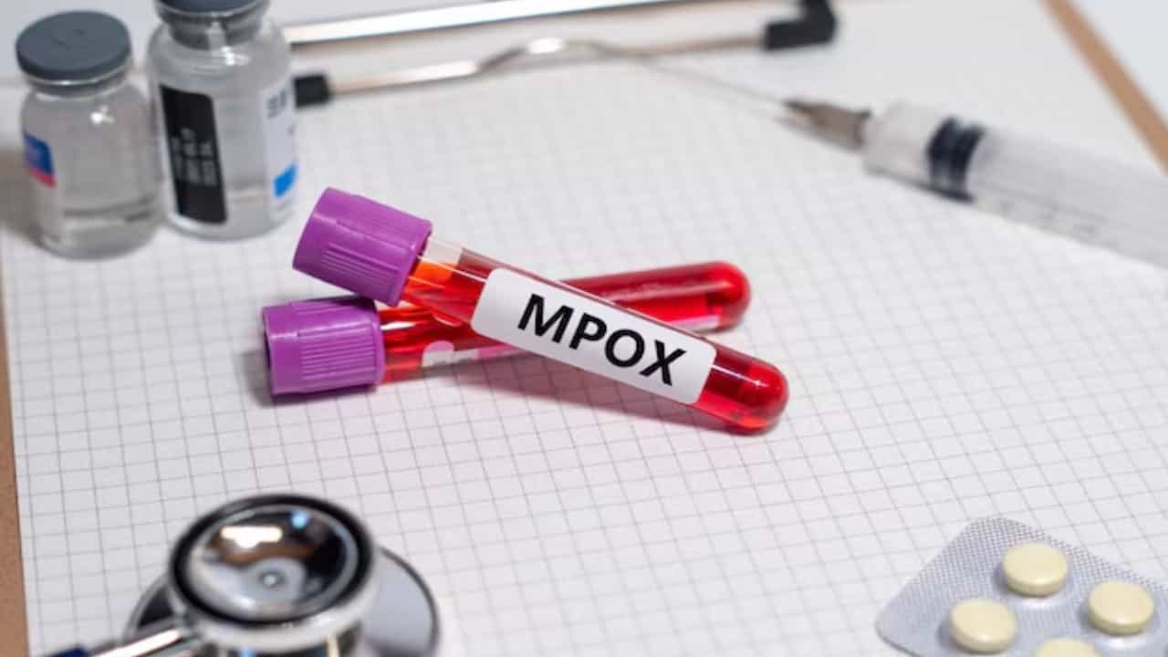 Mpox ಪ್ರಕರಣ: ವಿಮಾನ ನಿಲ್ದಾಣಗಳಲ್ಲಿ ಎಚ್ಚರಿಕೆ ವಹಿಸುವಂತೆ ಕೇಂದ್ರ ಸೂಚನೆ Mpox ಪ್ರಕರಣ: ವಿಮಾನ ನಿಲ್ದಾಣಗಳಲ್ಲಿ ಎಚ್ಚರಿಕೆ ವಹಿಸುವಂತೆ ಕೇಂದ್ರ ಸೂಚನೆ
