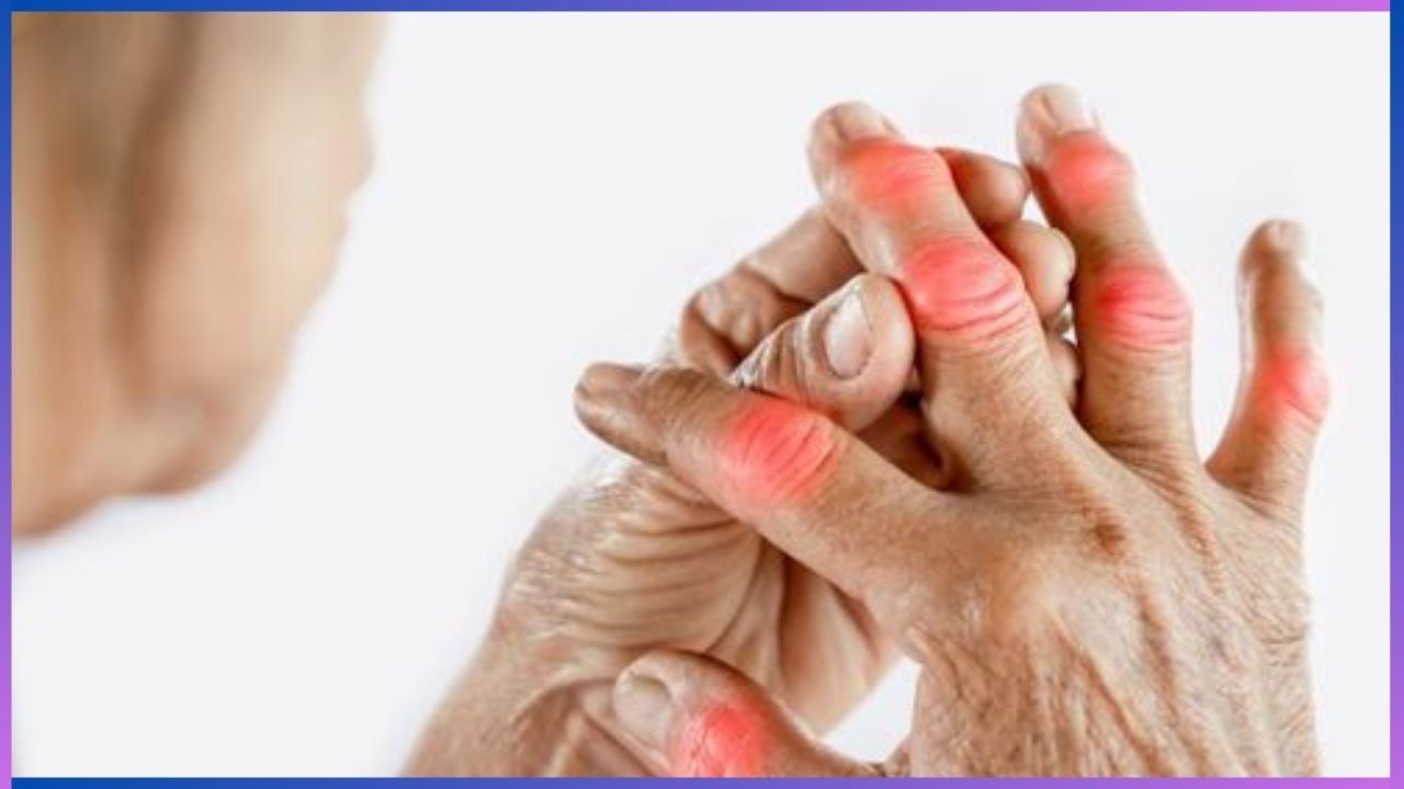 Rheumatoid Arthritis: ದೃಷ್ಟಿ ಸಮಸ್ಯೆ ಹೆಚ್ಚಾಗುತ್ತಿದ್ದರೆ ಈ ರೋಗದ ಲಕ್ಷಣ ಆಗಿರಬಹುದು ಎಚ್ಚರ!