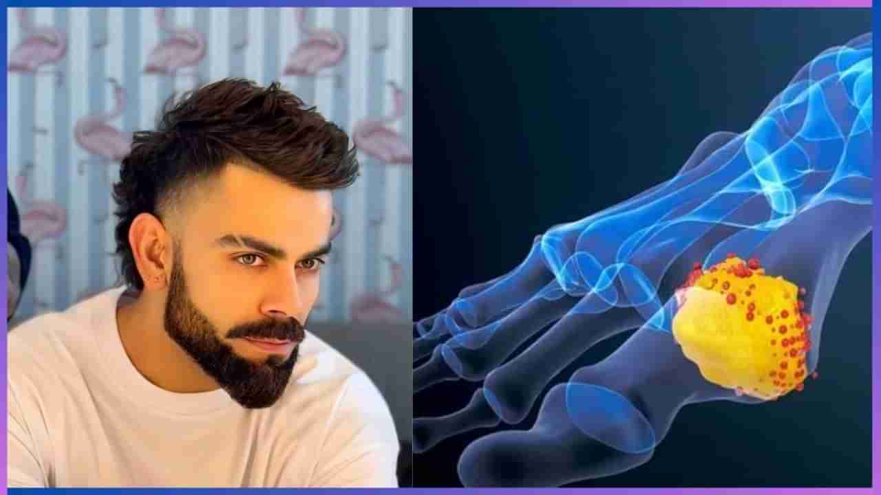 Virat Kohli Fitness: ವಿರಾಟ್ ಕೊಹ್ಲಿ ಮಾಂಸಾಹಾರಿಯಿಂದ ಸಸ್ಯಾಹಾರಿಯಾಗಲು ಕಾರಣವಾದ ಆರೋಗ್ಯ ಸಮಸ್ಯೆ ಯಾವುದು?