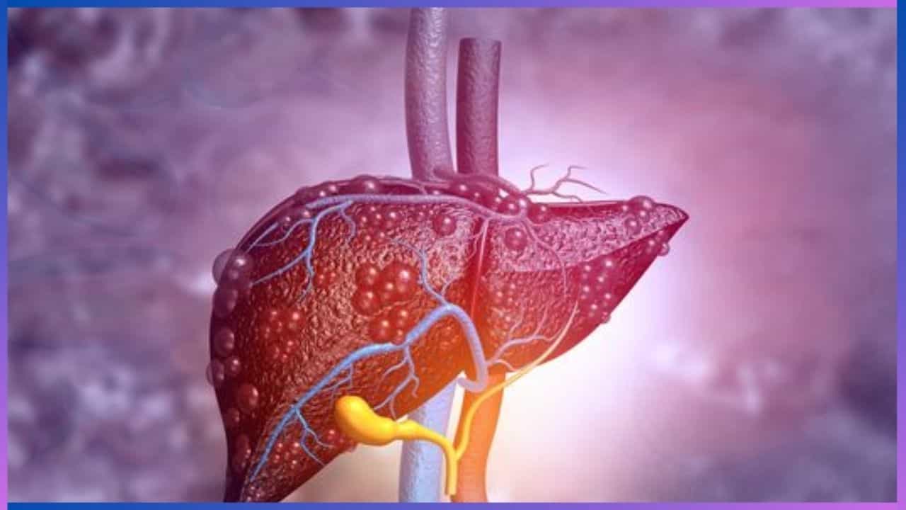 Liver Health: ರಾತ್ರಿಯಲ್ಲಿ ಈ ಲಕ್ಷಣಗಳು ಕಾಣಿಸಿಕೊಂಡರೆ ನಿಮ್ಮ ಲಿವರ್ ಅಪಾಯದಲ್ಲಿದೆ ಎಂದರ್ಥ Liver Health: ರಾತ್ರಿಯಲ್ಲಿ ಈ ಲಕ್ಷಣಗಳು ಕಾಣಿಸಿಕೊಂಡರೆ ನಿಮ್ಮ ಲಿವರ್ ಅಪಾಯದಲ್ಲಿದೆ ಎಂದರ್ಥ