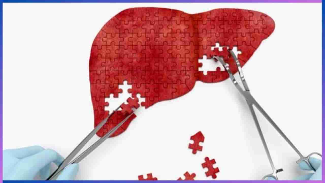 Liver Health: ಮುಂಜಾನೆ ಮಾಡುವ ಈ ತಪ್ಪುಗಳು ಲಿವರ್ ಲಿವರ್​​ಗೆ ತೊಂದರೆ ಮಾಡುತ್ತೆ