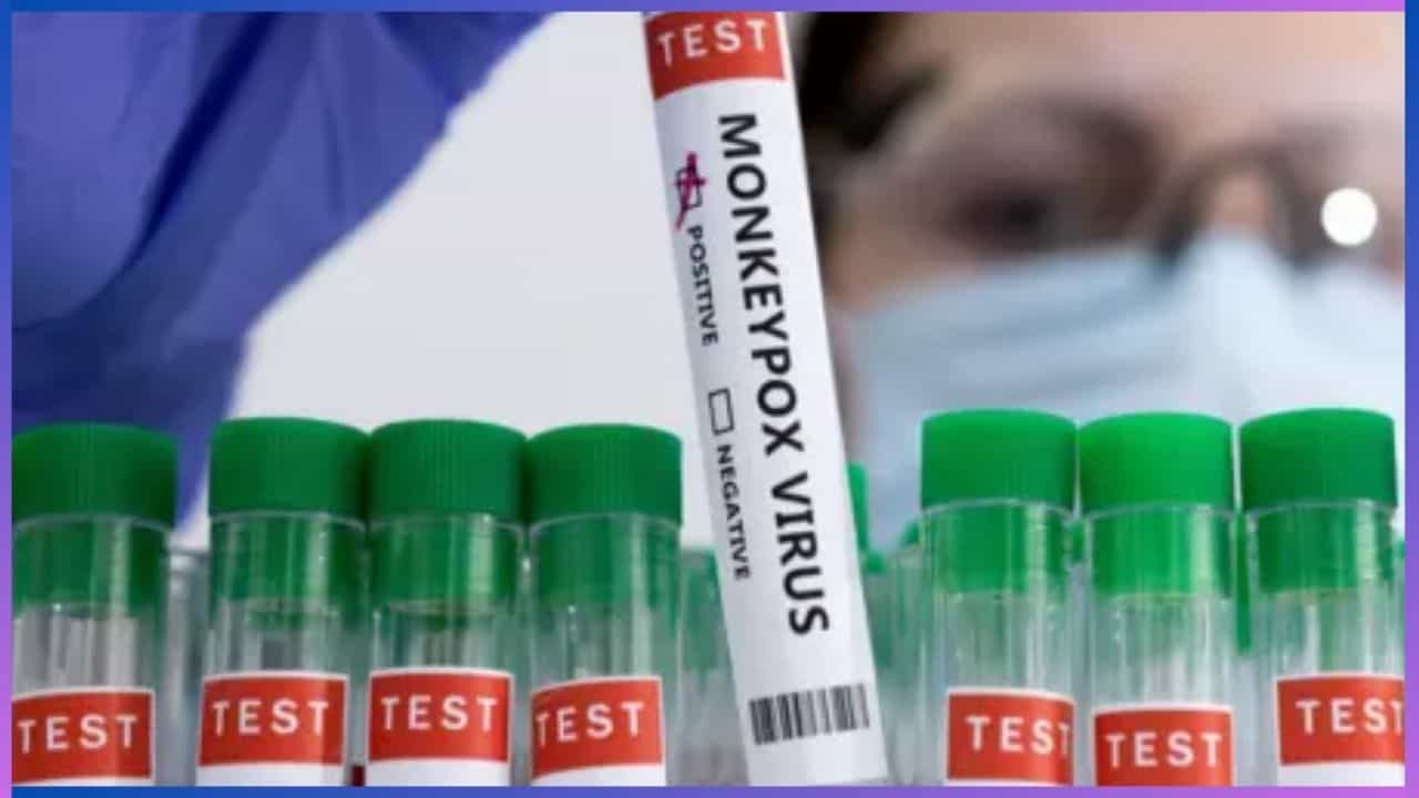 Monkeypox: ಮಂಕಿಪಾಕ್ಸ್ ವೈರಸ್ ನಿಂದ ಅಪಾಯವಿದೆಯೇ? ಹೇಗೆ ಮುನ್ನೆಚ್ಚರಿಕೆ ವಹಿಸಬೇಕು ತಿಳಿದುಕೊಳ್ಳಿ Monkeypox: ಮಂಕಿಪಾಕ್ಸ್ ವೈರಸ್ ನಿಂದ ಅಪಾಯವಿದೆಯೇ? ಹೇಗೆ ಮುನ್ನೆಚ್ಚರಿಕೆ ವಹಿಸಬೇಕು ತಿಳಿದುಕೊಳ್ಳಿ