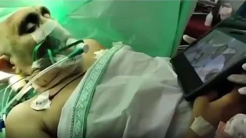Viral: ಬ್ರೈನ್ ಸರ್ಜರಿ ವೇಳೆ ಜೂನಿಯರ್ ಎನ್ಟಿಆರ್ ಸಿನಿಮಾ ವೀಕ್ಷಿಸಿದ ರೋಗಿ; ವೈರಲ್ ಆಯ್ತು ವಿಡಿಯೋ