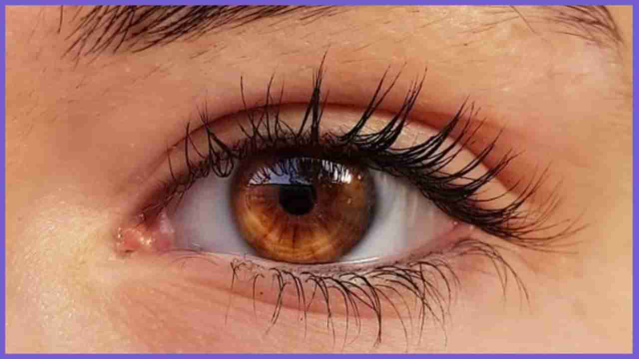 Eye Care: ಕಣ್ಣಿನ ಕೆಳಭಾಗದಲ್ಲಿ ತೆಂಗಿನ ಎಣ್ಣೆಯಿಂದ ಮಸಾಜ್ ಮಾಡಿದರೆ ಏನಾಗುತ್ತೆ ನೋಡಿ