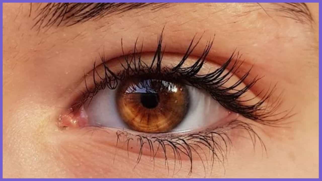 Eye Care: ಕಣ್ಣಿನ ಕೆಳಭಾಗದಲ್ಲಿ ತೆಂಗಿನ ಎಣ್ಣೆಯಿಂದ ಮಸಾಜ್ ಮಾಡಿದರೆ ಏನಾಗುತ್ತೆ ನೋಡಿ Eye Care: ಕಣ್ಣಿನ ಕೆಳಭಾಗದಲ್ಲಿ ತೆಂಗಿನ ಎಣ್ಣೆಯಿಂದ ಮಸಾಜ್ ಮಾಡಿದರೆ ಏನಾಗುತ್ತೆ ನೋಡಿ