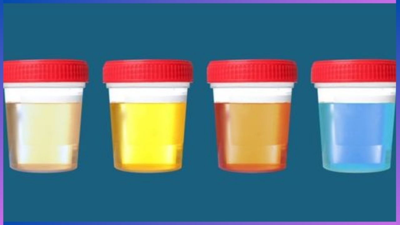 Urine Colour: ಮೂತ್ರದ ಬಣ್ಣದಲ್ಲಿ ಅಡಗಿದೆ ಆರೋಗ್ಯದ ಗುಟ್ಟು