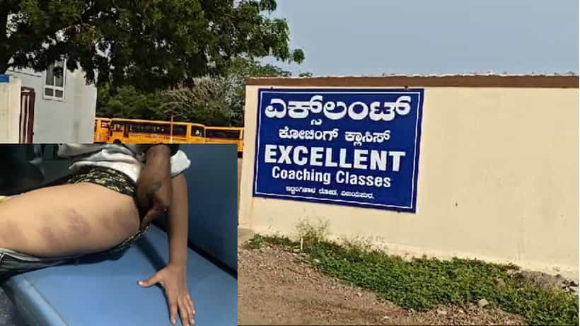 ಗಣಿತದಲ್ಲಿ ಕಡಿಮೆ ಅಂಕ ಬಂತೆಂದು ವಿದ್ಯಾರ್ಥಿ ಮೇಲೆ ತೀವ್ರವಾಗಿ ಹಲ್ಲೆ ನಡೆಸಿದ ಕೋಚಿಂಗ್ ಸೆಂಟರ್ನ ವಾರ್ಡನ್