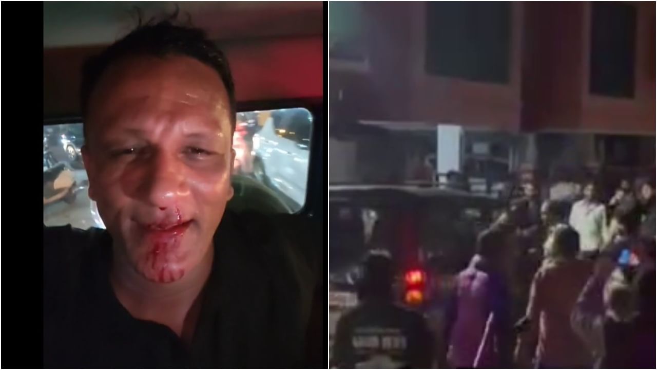 VIDEO: ಪೊಲೀಸ್ ಇದ್ದರೂ ಡೋಂಟ್ ಕೇರ್; ಎಷ್ಟು ಭೀಕರವಾಗಿತ್ತು ನೋಡಿ ಜಗದೀಶ್ ಕಾರಿನ ಮೇಲಿನ ಅಟ್ಯಾಕ್ VIDEO: ಪೊಲೀಸ್ ಇದ್ದರೂ ಡೋಂಟ್ ಕೇರ್; ಎಷ್ಟು ಭೀಕರವಾಗಿತ್ತು ನೋಡಿ ಜಗದೀಶ್ ಕಾರಿನ ಮೇಲಿನ ಅಟ್ಯಾಕ್