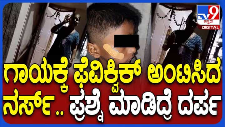 ಏಳು ವರ್ಷದ ಬಾಲಕನ ಕೆನ್ನೆ ಮೇಲಿನ ಆಳ ಗಾಯಕ್ಕೆ ಫೆವಿಕ್ವಿಕ್ ಮೆತ್ತಿ ಚಿಕಿತ್ಸೆ ನೀಡಿದ ಹಾವೇರಿಯ ನರ್ಸ್ ಜ್ಯೋತಿ! ಏಳು ವರ್ಷದ ಬಾಲಕನ ಕೆನ್ನೆ ಮೇಲಿನ ಆಳ ಗಾಯಕ್ಕೆ ಫೆವಿಕ್ವಿಕ್ ಮೆತ್ತಿ ಚಿಕಿತ್ಸೆ ನೀಡಿದ ಹಾವೇರಿಯ ನರ್ಸ್ ಜ್ಯೋತಿ!